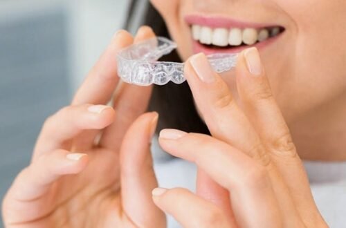 Transform Your Smile with Teeth Straightening