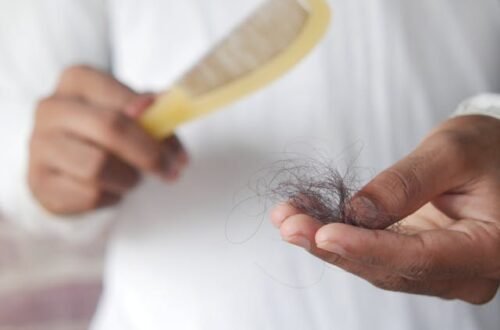 Addressing Thinning Hair: Your Starting Point