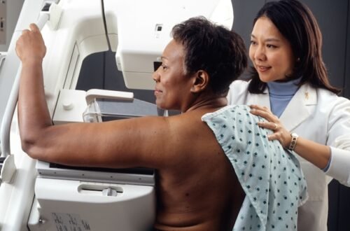 When to Schedule a Mammogram Screening?